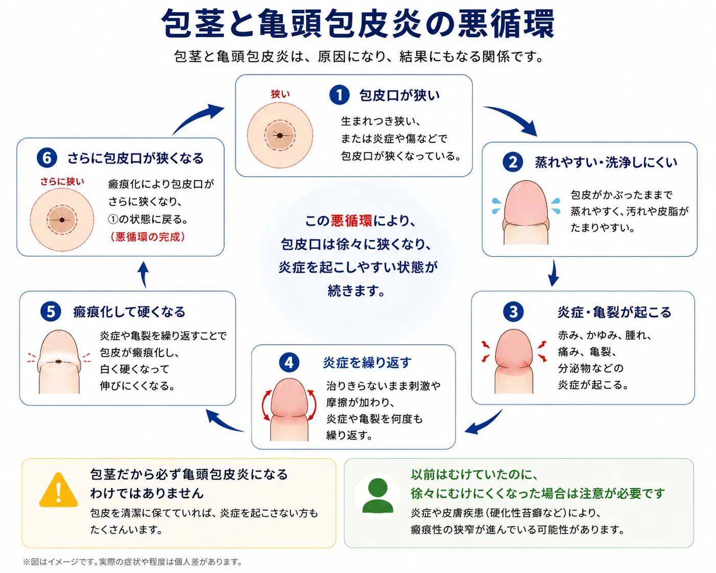 包茎と亀頭包皮炎の関係｜赤み・かゆみを繰り返す原因と治療